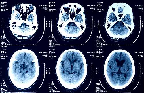 PSA: You shouldn't upload your medical images to AI chatbots | TechCrunch