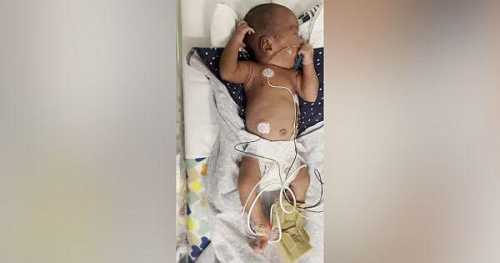 Black Newborn Baby With Fractured Leg Sparks Child Abuse Investigation at Virginia Hospital